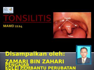 mamd 2114 tonsilitis.ppt